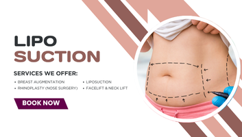 Liposuction