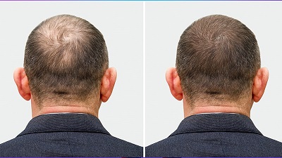Before and After 3