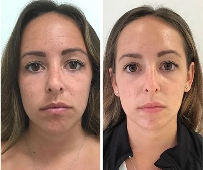 Before and After 4