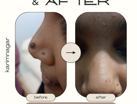 Before and After 1