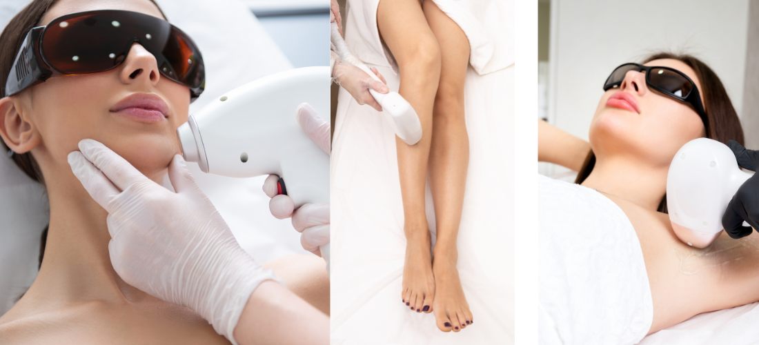 Laser Hair Removal Treatment